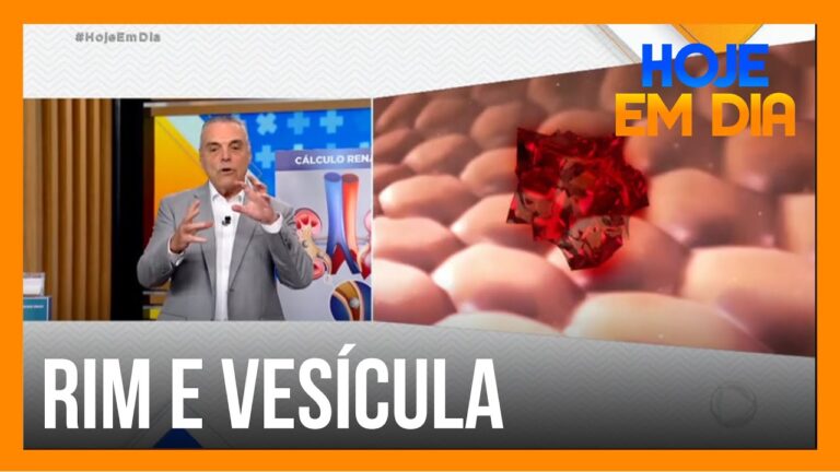 Pedra na Vesícula e Sua Relação com Infecção Urinária