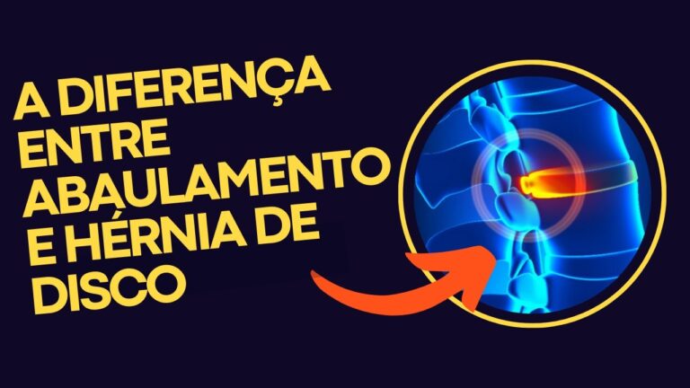 Hérnia de Disco vs. Abaulamento Discal: Entenda as Diferenças