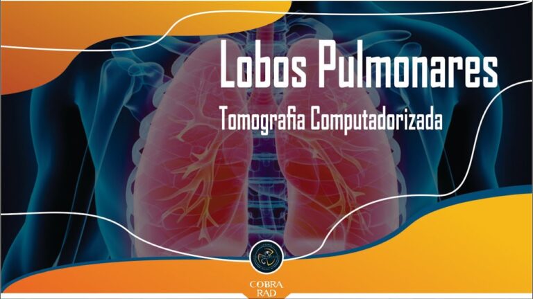 Entendendo o Lobo Médio Pulmonar: Funções e Patologias