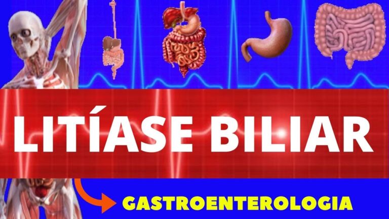 Entendendo a Litiase Biliar: Causas e Tratamentos