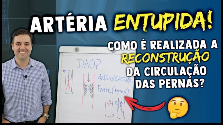 M&eacute;todos Eficazes para Desentupir Veias da Perna