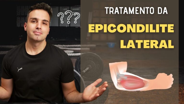 Rem&eacute;dios Eficazes para Epicondilite: Al&iacute;vio e Tratamento