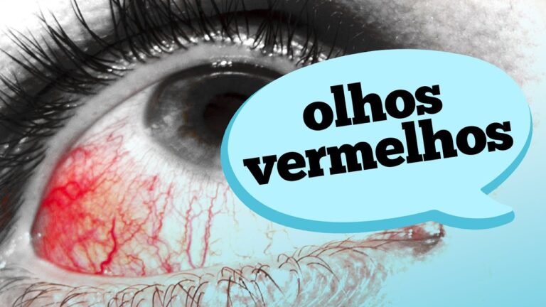 Causas da Vermelhidão nos Olhos: O Que Pode Ser?