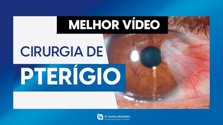 Entendendo a Cirurgia de Pterígio: Procedimento e Recuperação