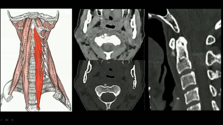 Análise do Raio X da Coluna Cervical e Interpretação do Laudo