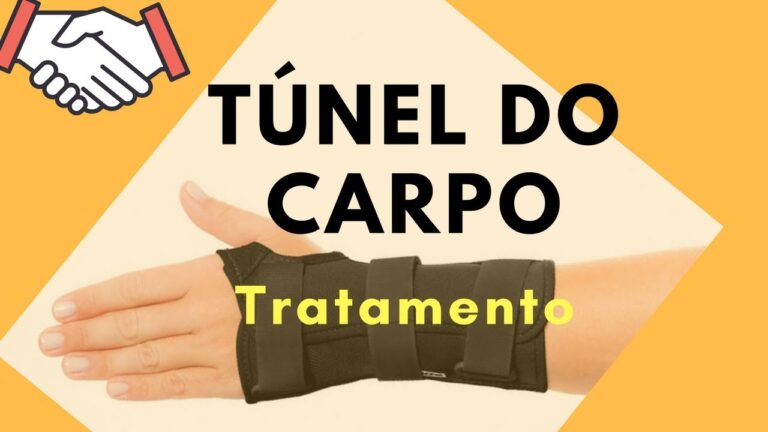 Gestão Eficaz do Síndrome do Túnel do Carpo Bilateral de Grau Moderado