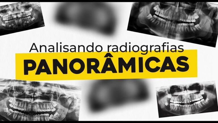 Valor da Radiografia Panorâmica na Prática Odontológica
