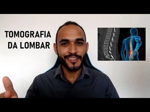 Interpretação do Resultado da Tomografia da Coluna Lombar
