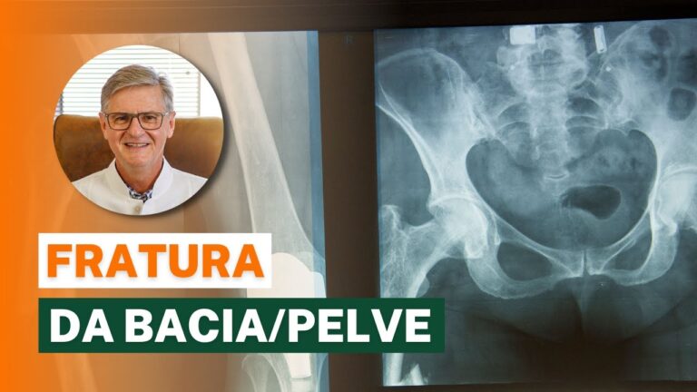 Fratura na Bacia em Idosos: Causas e Cuidados Essenciais