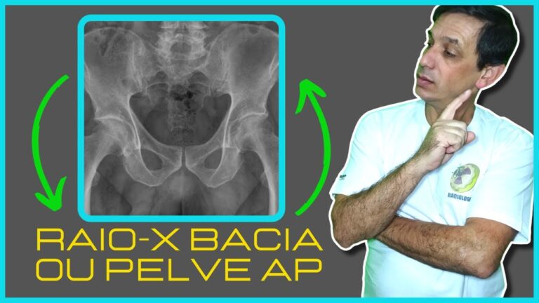 Raio-X da Bacia: A Necessidade de Despir a Roupa