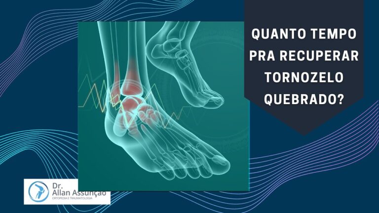 Recuperação Eficiente de Tornozelo Quebrado