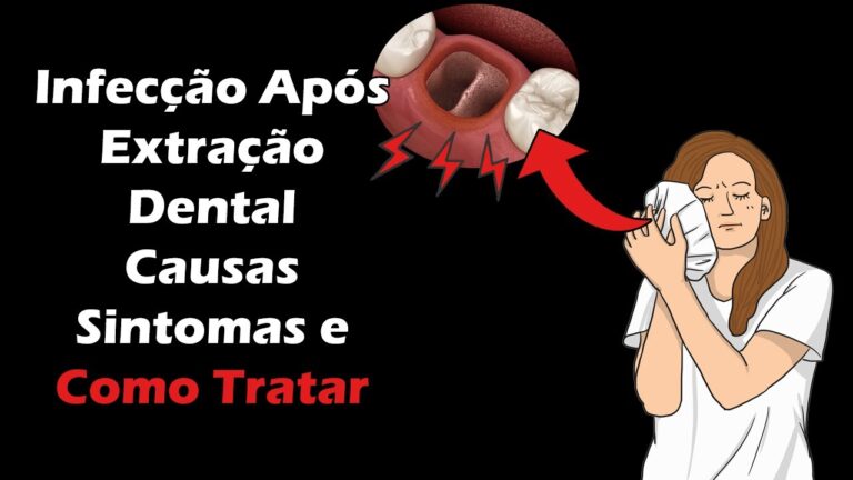 Dente Inflamado Após Extração: Causas e Cuidados Essenciais