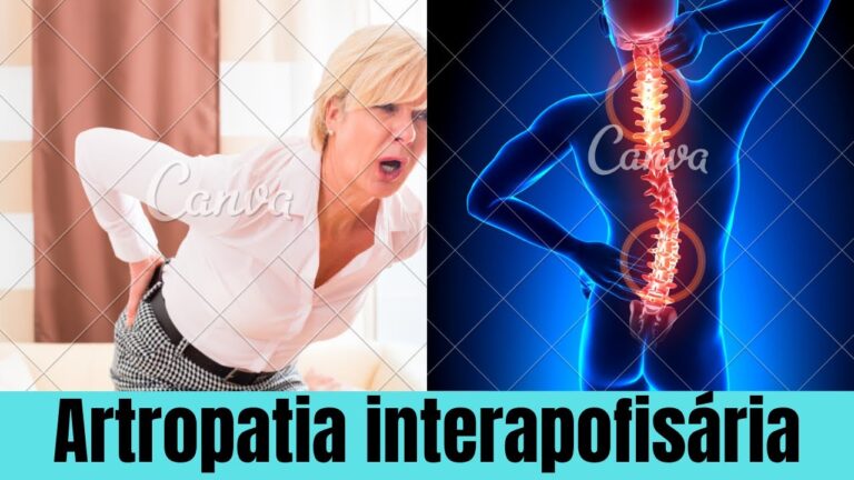 Entendendo a Artrose Interapofisária Difusa: Causas e Tratamentos