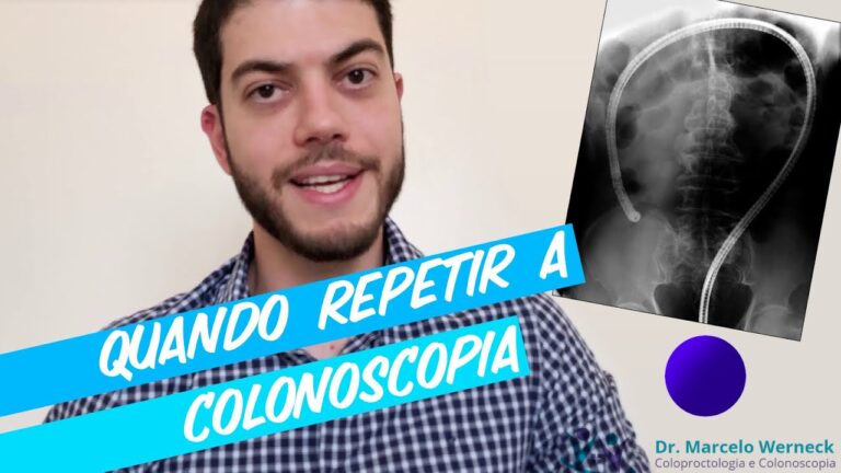 Frequência Ideal para Realizar Colonoscopias