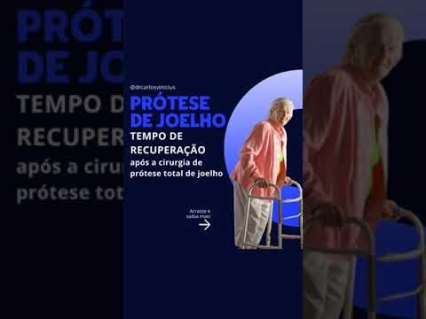 Tempo de Cirurgia na Artroplastia de Joelho: O Que Você Precisa Saber