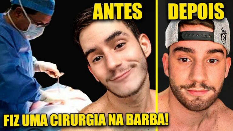 Valor do Implante de Barba: Guia Completo e Considera&ccedil;&otilde;es