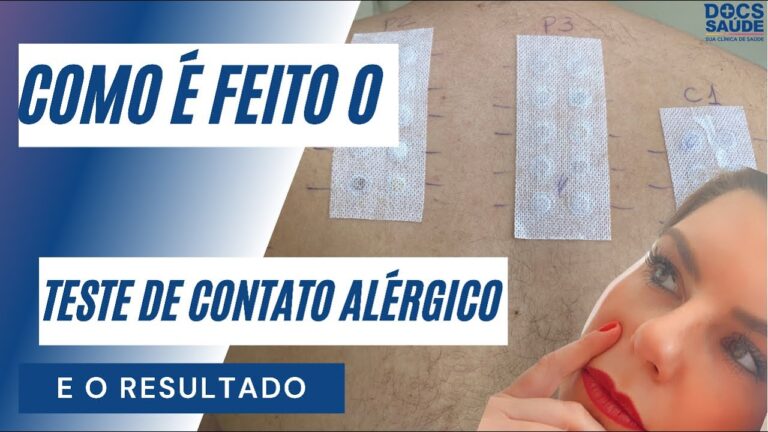 Teste de Contato: Otimização da Bateria Padrão
