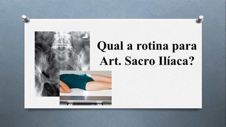 Raio X da Sacro Iliaca: Importância e Interpretação