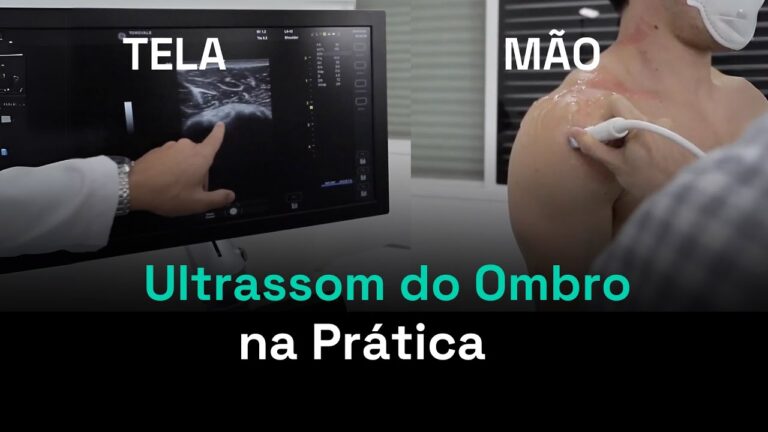 Ultrassom do Ombro Direito: Importância e Interpretação