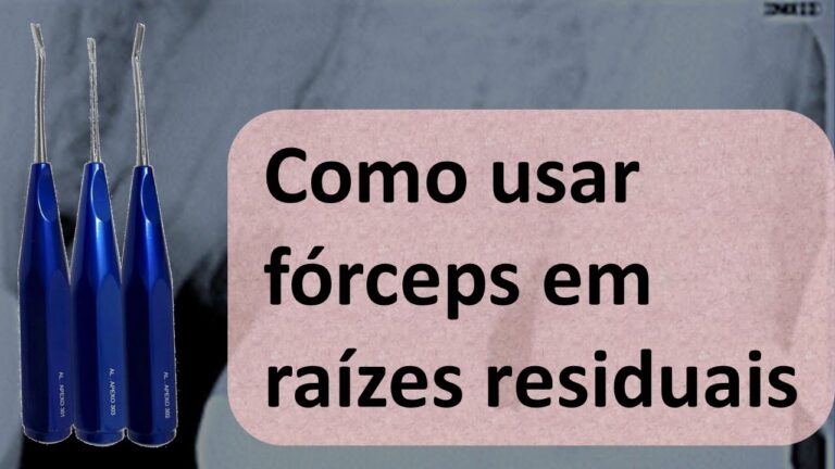 Uso Eficiente de Forceps para Raiz Residual Inferior