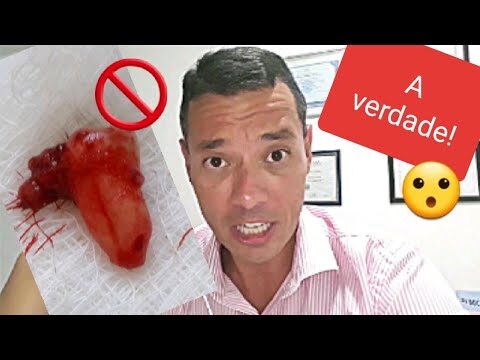 É Perigoso Arrancar o Dente Siso?