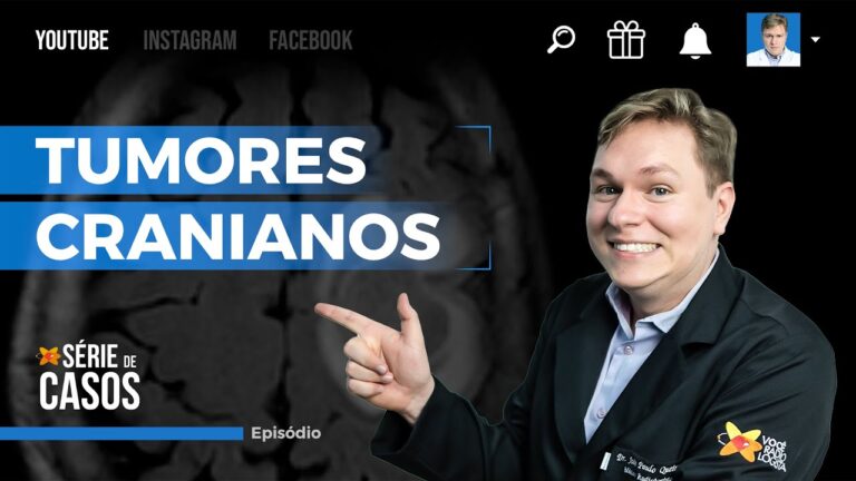 Raio X do Crânio: Identificação de Tumores