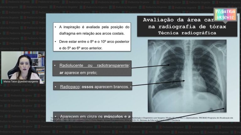 RX em Crianças: Importância e Cuidados