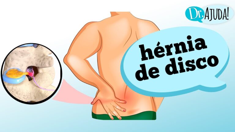 Hérnia de Disco no Joelho: Mitos e Verdades