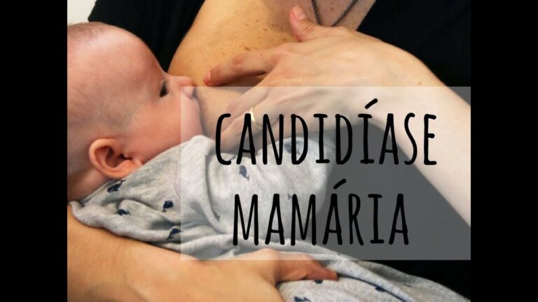 Candidíase Mamária: Entendendo a Relação com a Pega do Bebê