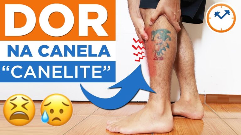 Dor na Canela ao Caminhar: Causas e Soluções Eficazes