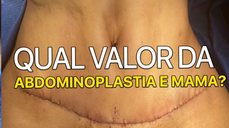 Abdominoplastia com Lipo e Silicone: Preços e Benefícios