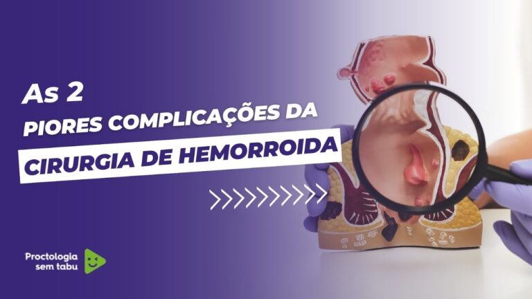 Efeitos Secundários da Cirurgia de Hemorroidas
