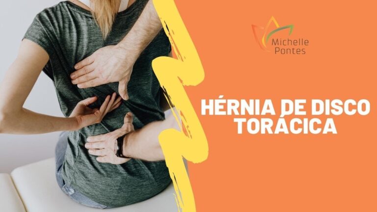 Sintomas da Hernia de Disco Torácica: O Que Você Precisa Saber
