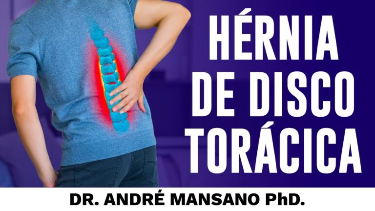 Hernia de Disco na Coluna Torácica: Causas e Tratamentos Eficazes