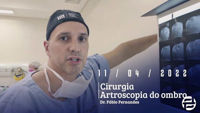 Cirurgia Artroscópica no Ombro: Avanços e Benefícios