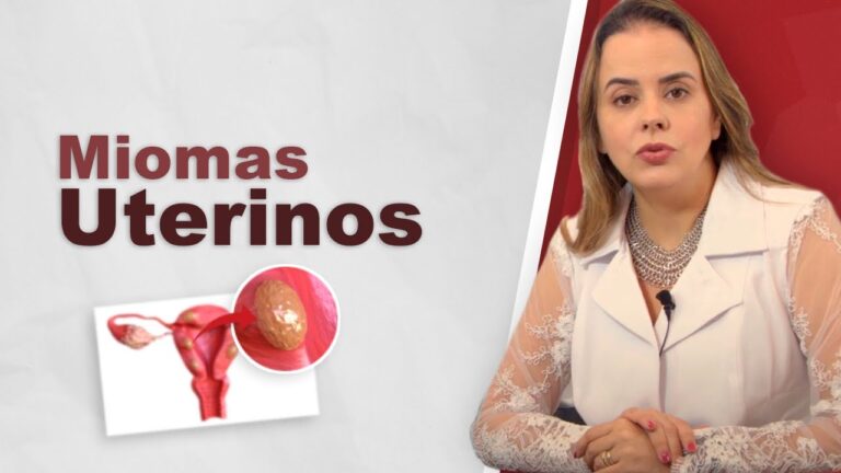 Nódulos Miometriais: Relação com Leiomiomas