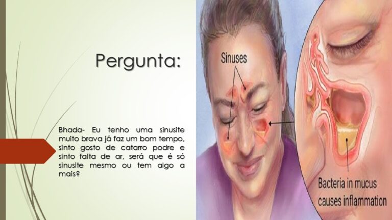 Catarro com Gosto de Podre: Causas e Soluções