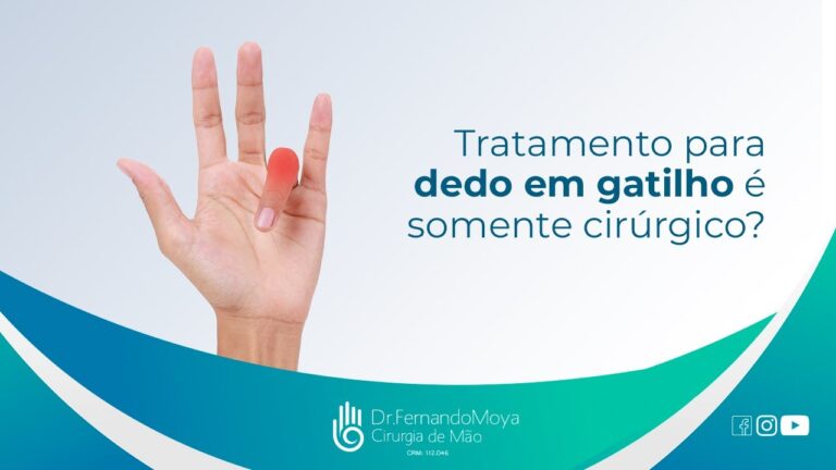Custo da Cirurgia no Dedo da Mão: Fatores e Considerações