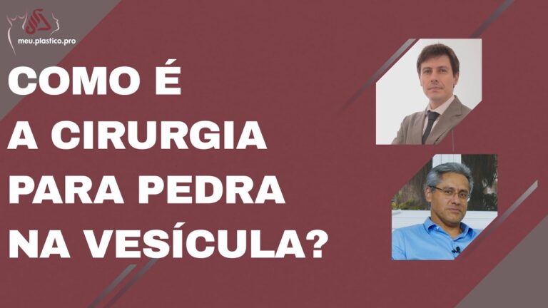Cirurgia Eficaz para Pedra na Vesícula