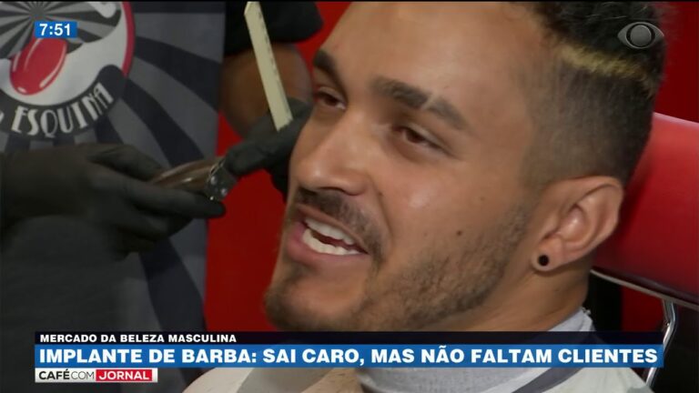 Custo do Implante de Barba: Tudo que Voc&ecirc; Precisa Saber