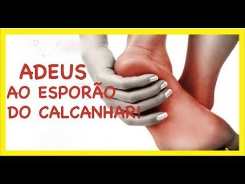 Fisioterapia no Tratamento do Esporão de Calcâneo