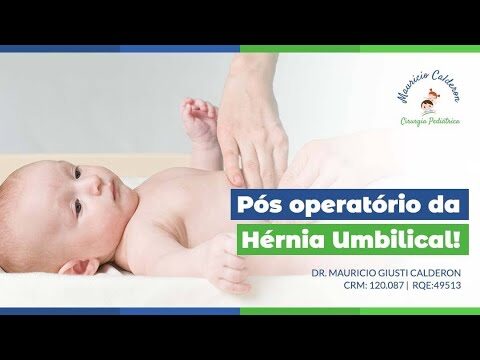 Cirurgia da Hérnia Umbilical Infantil: O Que Você Precisa Saber