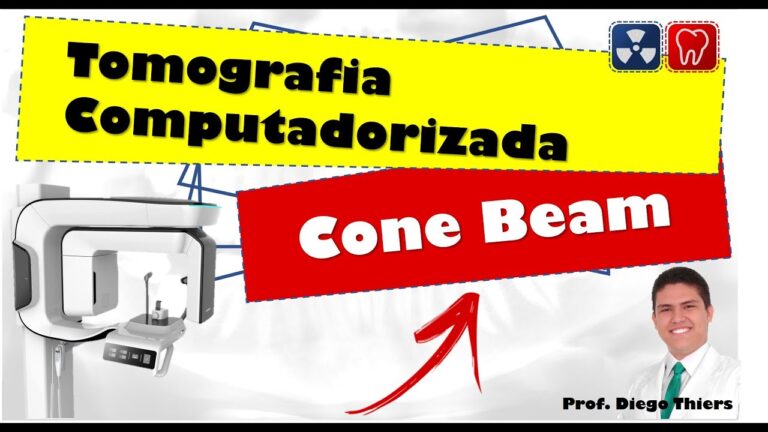 Comparativo de Pre&ccedil;os da Tomografia Cone Beam