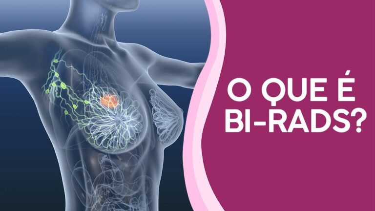 Acr BI-RADS Categoria 2: Entenda o que é e suas implicações