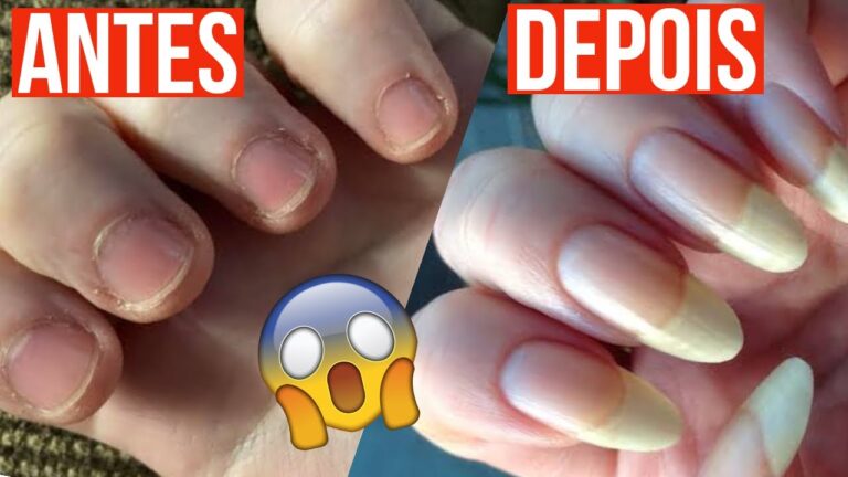 M&eacute;todos Caseiros para Acelerar o Crescimento dos Dentes