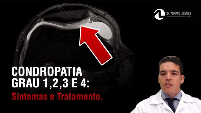 Entendendo a Condropatia Grau 2: Causas e Tratamentos