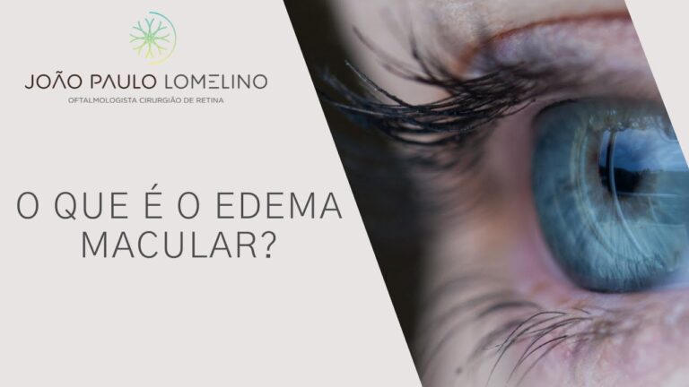 Causas e Tratamentos da Retina Inchada
