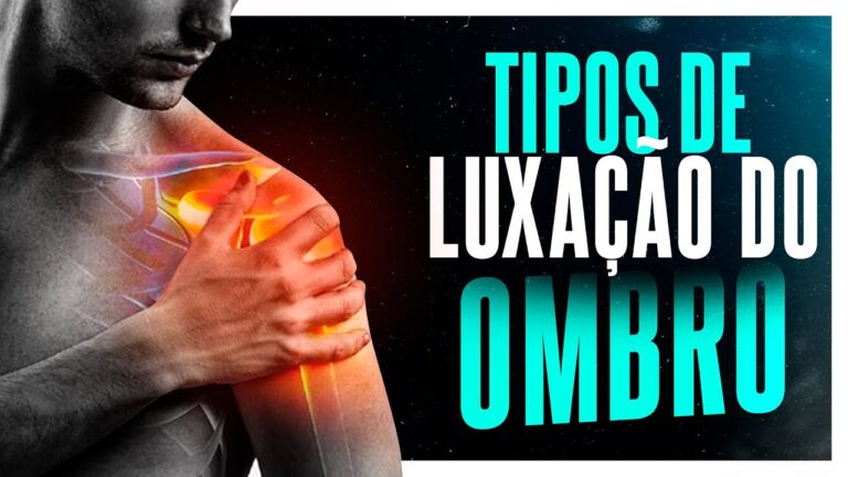 Tipos de Luxação de Ombro: Entenda as Variedades e Tratamentos