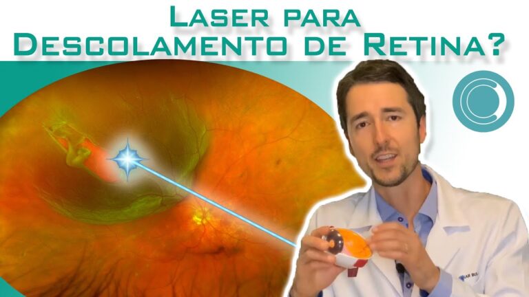 Custo da Cirurgia a Laser na Retina: O Que Considerar