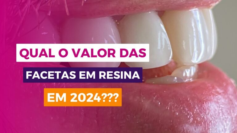 Lentes de Contato Dental: Valor e Benef&iacute;cios